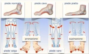 posturologia e podoposturologia napoli