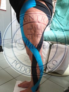 TAPING NEUROMUSCOLARE NAPOLI